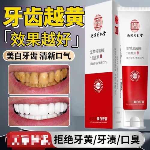 南京同仁堂美白牙膏口臭黄牙渍烟渍牙垢菌斑清洁护龈洁白牙齿 一盒
