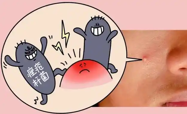 想告诉全世界这玩意祛痘真行