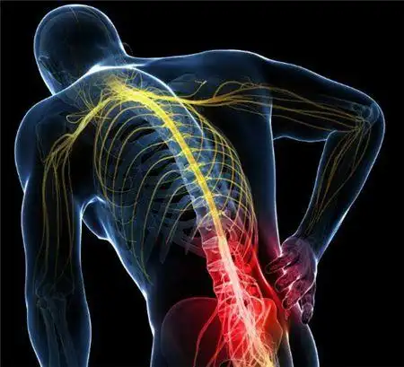 敲敲大腿,缓解腰突,腰腿疼,腰肌劳损.