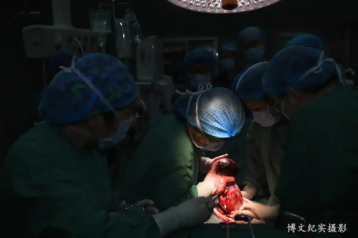 不久前,泰城人民揪心牵挂并纷纷为之献血的那位胎盘植入高危孕妇 - 抖