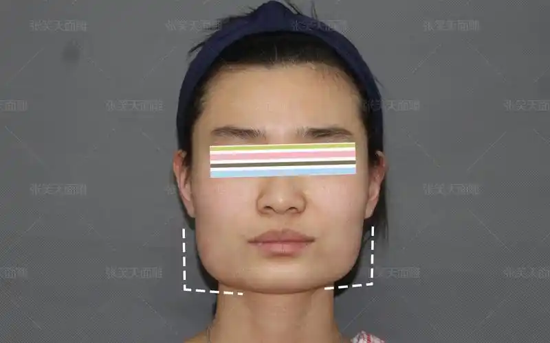 活动  方脸女孩系列|国字脸?正方形?