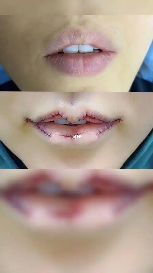 漂亮的m唇即可效果