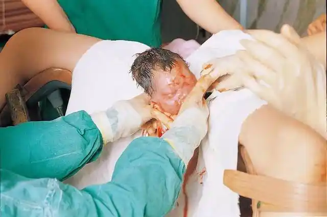 产房实拍顺产分娩过程