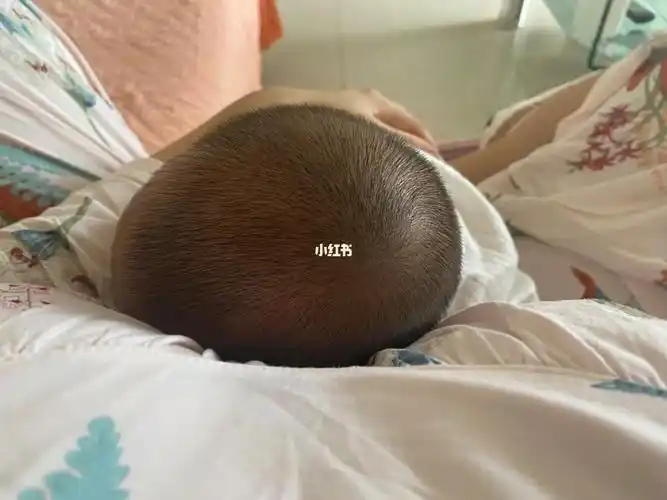 头型,舟状头_头型_母婴_育儿验