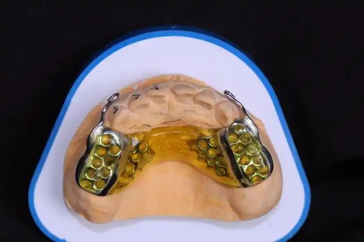 上领口内粘接式前方牵引器-矫治器-西安华冠用品有限公司|华冠用品