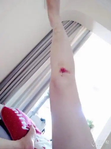 今天摔了一跤悲催幸亏娃没事