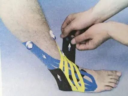 涨知识运动康复神器肌内效贴布