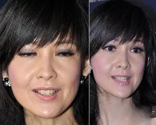 细数因烂牙变丑明星高圆圆整完成女神