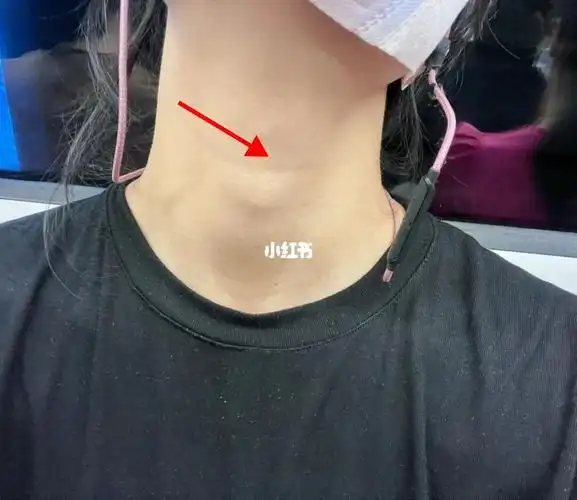 女生长喉结,0101谁能给我解释一下吗?男生?