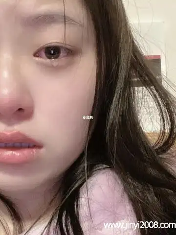 哭完后眼睛肿怎么办经常哭对身体的影响