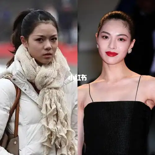 钟楚曦否认整容,你信吗?