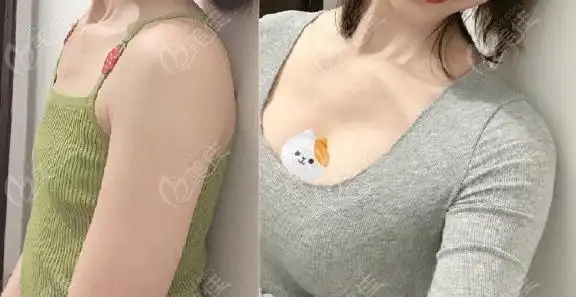 宝俪220cc和傲诺拉255cc哪个好