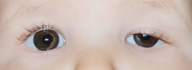 宝宝的眼睛有秘密,如果孩子出现这5种"怪眼",家长一定要警惕