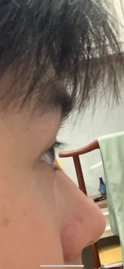 请问下各位这算眼球突出吗