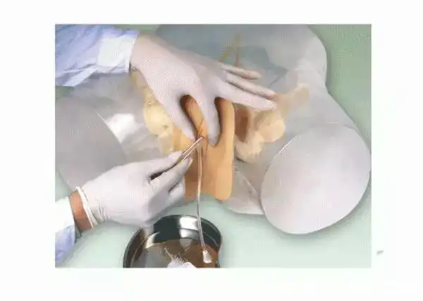 膀胱导尿术之导尿管的选择标准,用错会伤害尿道引发感染