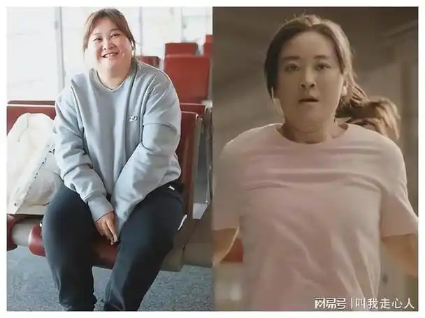 贾玲暴瘦百斤现状曝光后遗症竟是脖子皮肤松弛耷拉