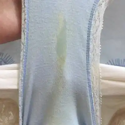 请问下其他的宝妈们,你们有没有这种情况就是裤子上有一些黄色的液体