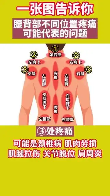 后背不同位置疼痛,可能疼痛问题不一样