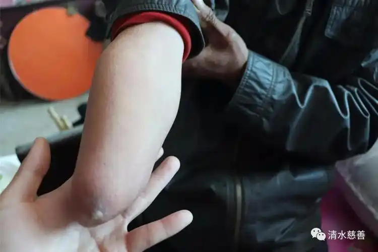 苦难总有尽头贫苦也要坚持清水慈善为庄河市荷花山镇