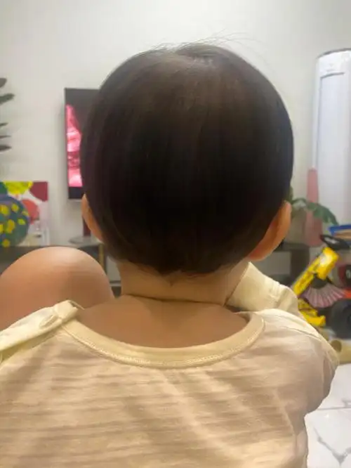 后脑勺  #婴儿头型到底怎么睡