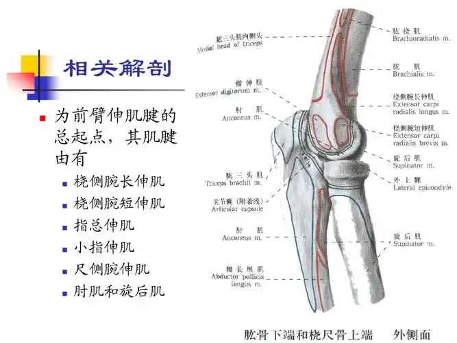 肱骨外上髁炎ppt课件ppt17页