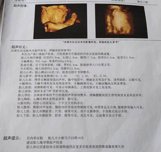 22日,记者从许先生提供的四维超声报告单上看到,报告单显示有"腹腔内