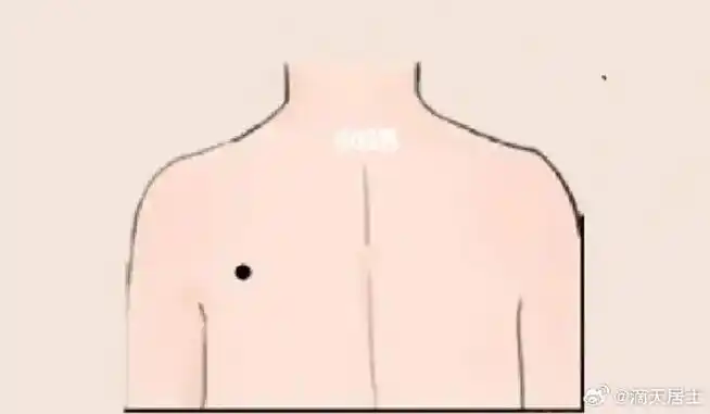 此处的痣也是有所说法,是多有好的现象,特别多利经济,所以后背这个痣