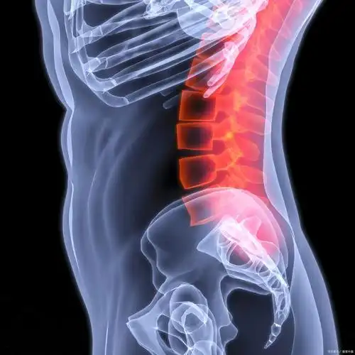 后腰左侧疼痛是什么原因