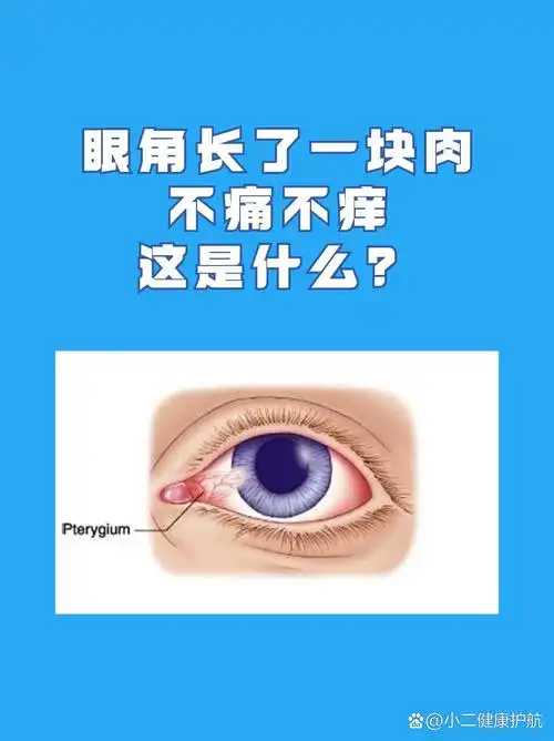 眼角长了一块肉,这是什么?