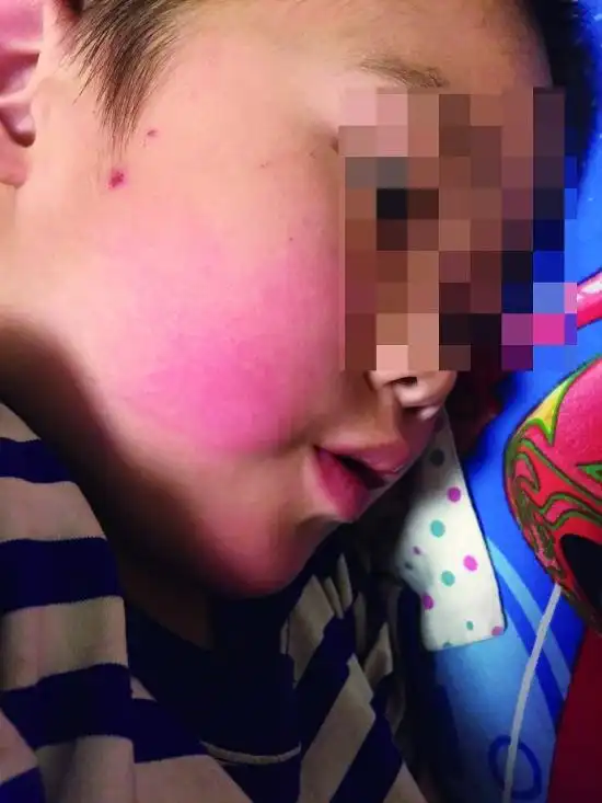 一名被打的孩子.