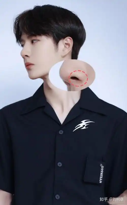 王一博鼻子上的疤痕是怎么造成的?