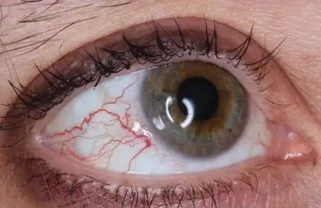 肝脏不好的人能不能吃玉米?出现这些情况时,建议注意起来