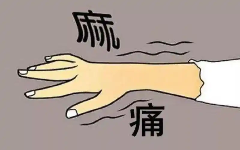 手麻,手痛,无力,你可能得的不是颈椎病和腕管综合征,而是