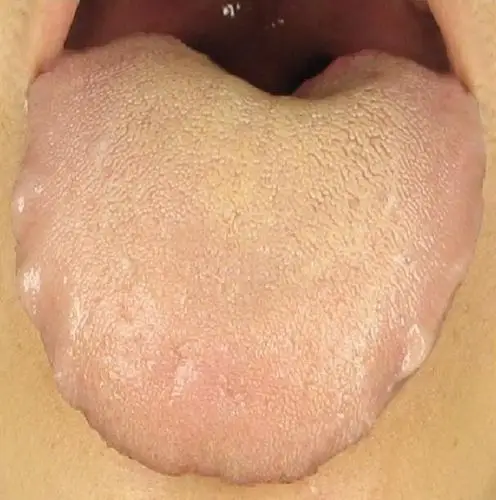 大国医说养生 | 看舌头颜色,竟能判断自己的身体状况