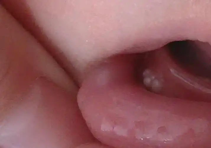 这几个传统育儿陋习,会严重影响宝宝的生长发育_马牙