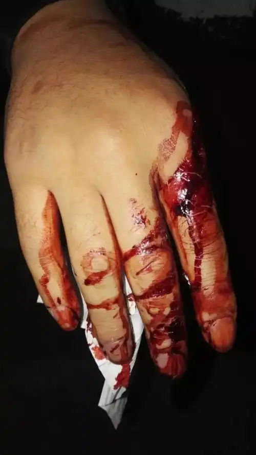 濮阳这家ktv聚众持械斗殴流血并暴力攻击民警!多人被拘留!