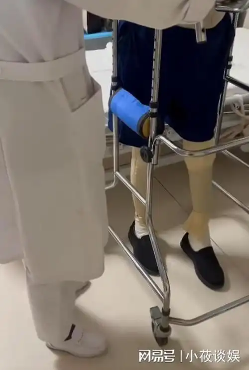 消防员救火全身烧伤93%,女友不离不弃,如今还为其怀孕生子|刘攀|截肢