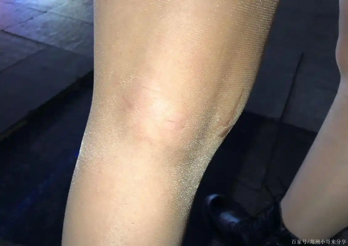 郑州二七广场遇见一个变态,往丝袜上喷不明液体