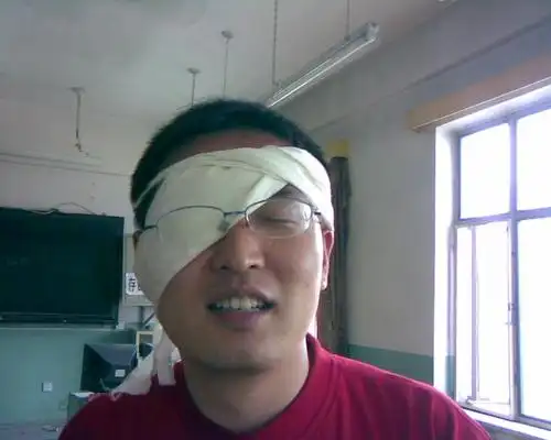 (单眼包扎)
