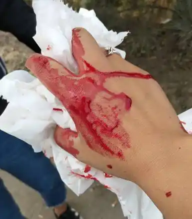 被打的满脸是血孩子吓得不轻永清女子寻找打人电动三轮司机