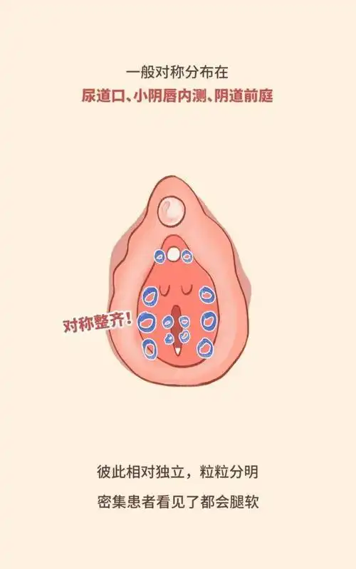 不要小看这一圈肉疙瘩,它们是伴侣间的定时炸弹 | 女性安全指南174