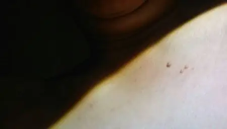 原因是我想小时候这里不知道为啥长疮,好了后,这里就多了几颗肉疙瘩