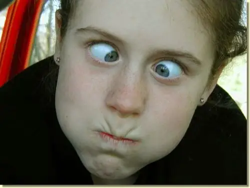 斗鸡眼图片 (16)