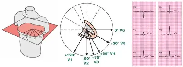 心电图理论笔记8:心电轴