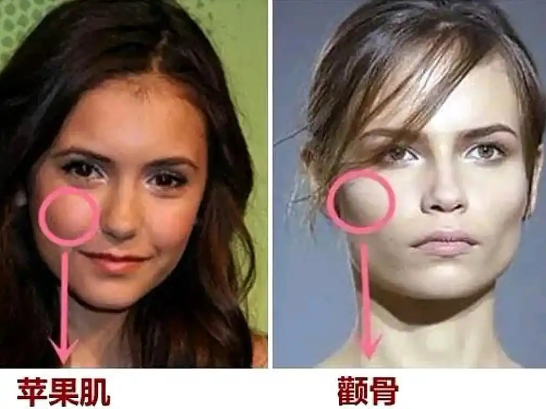 真相——苹果肌下垂,真的会让人显老!