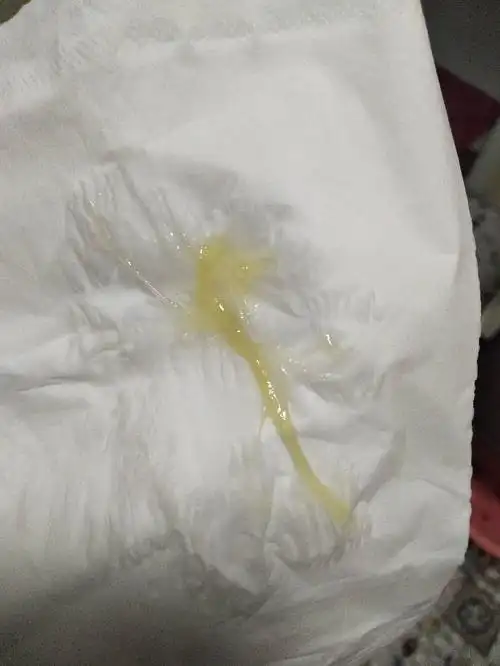 超预产期9天了, 去厕所,下面流出这种液体,是怎么回事啊?