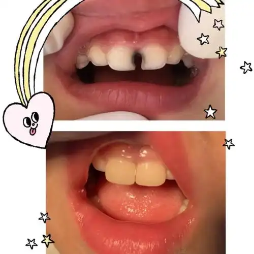 在健美与快乐中我们一起成长——广济口腔特色科室之儿牙中心