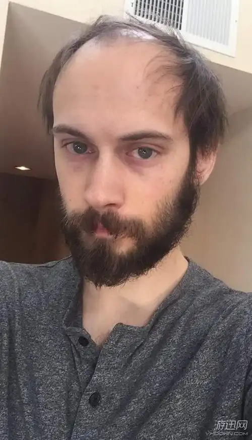 做英雄真让人秃头lol设计师晒6年发型对比照