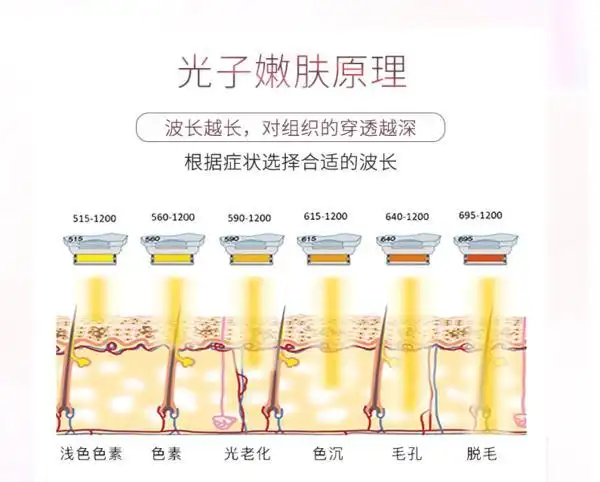 光子嫩肤的治疗原理是通过采用特定宽光谱彩光直接照射于皮肤表面