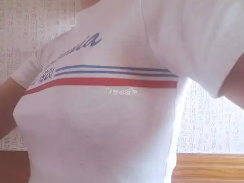 赛彬胸12天,"胸"感强烈_韩国整形社区_韩国整容问答_韩国整形经验交流